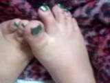 YUM YUMS GREEN TOES